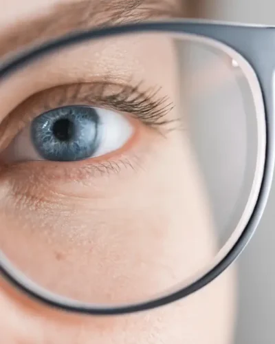 ÓTICAS VIDERE IMAGENS (4)